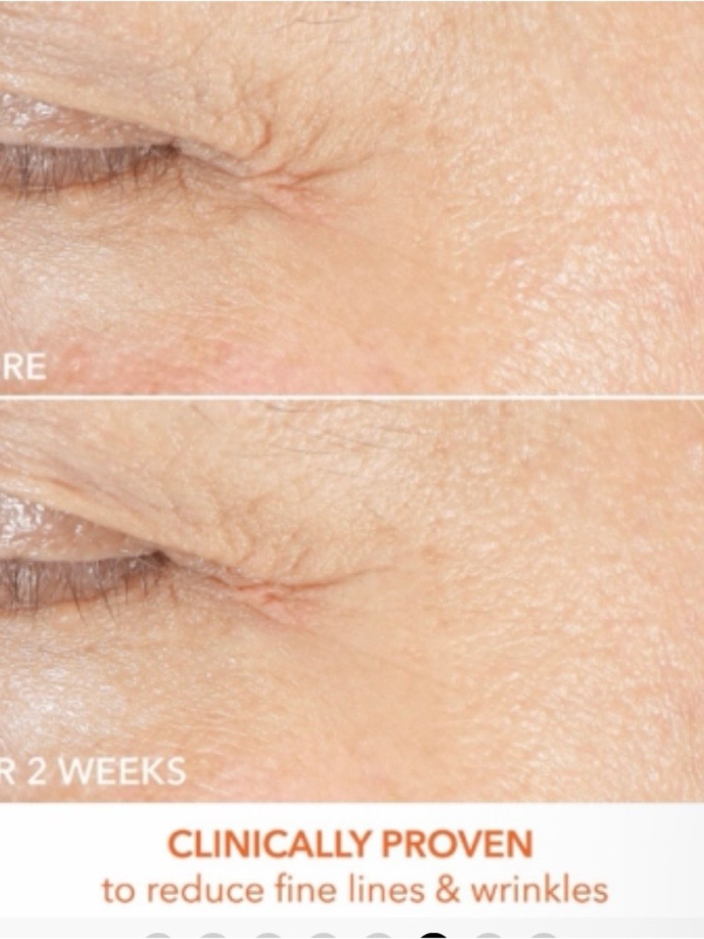 DR. DENNIS GROSS Firm & Bright Eye Cream 0.5oz - Picture 6 of 9